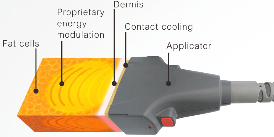 1060 nm diode laser machine-6