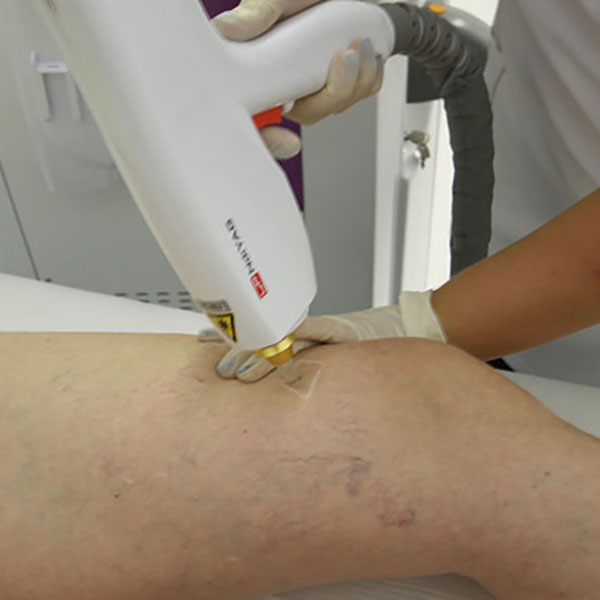 High Performance Permanent Tattoo Removal Product -
Platform Series-HS-900 – Apolo detail pictures