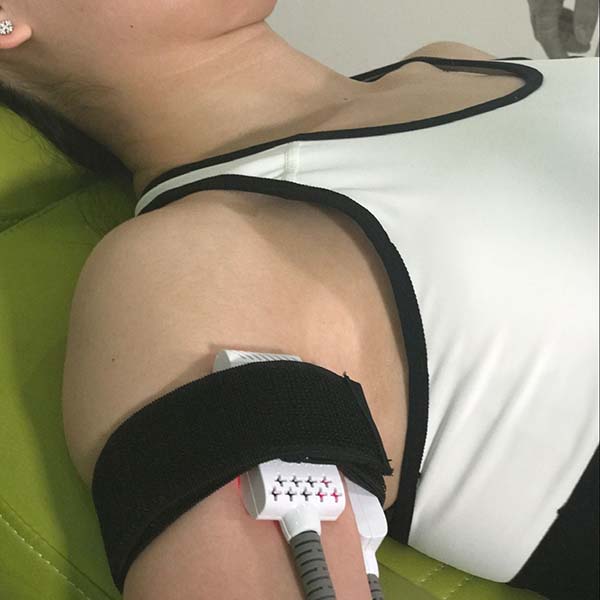 Factory Outlets Co2 Laser For Acne Scars -
lipo laser HS-700 – Apolo detail pictures