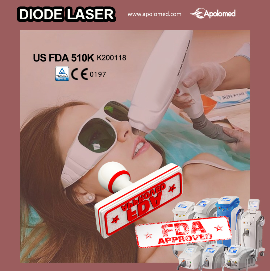 Na Diode lasers e Lokela ho Rekoa?