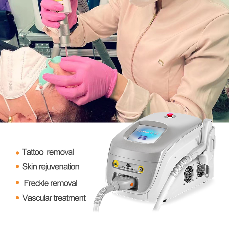 Smart ways to select the perfect Q-switched laser machine