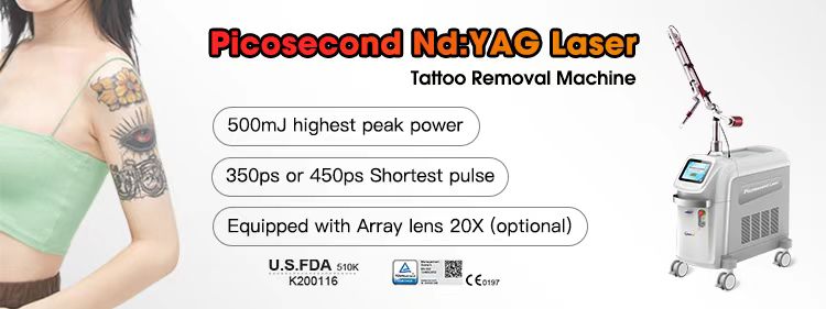 Picosecond ND YAG Laser HS-298