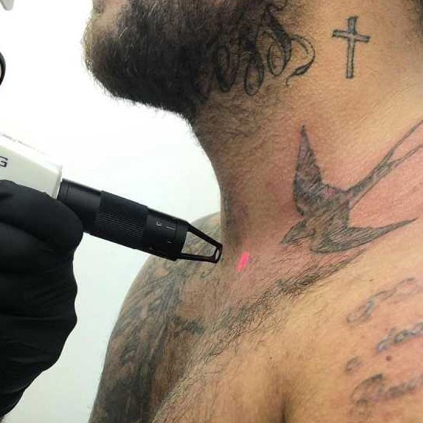 High Performance Permanent Tattoo Removal Product -
Platform Series-HS-900 – Apolo detail pictures